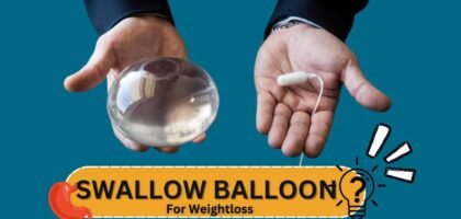 Swallow Balloon For Weight loss