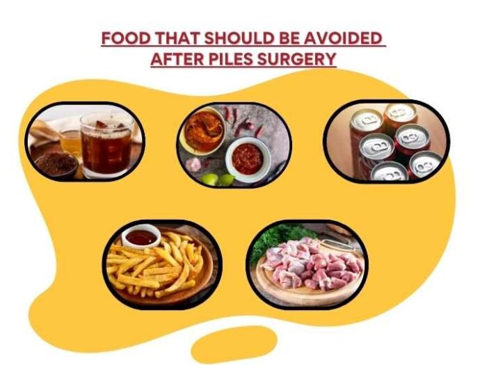 Foods to eat after piles surgery