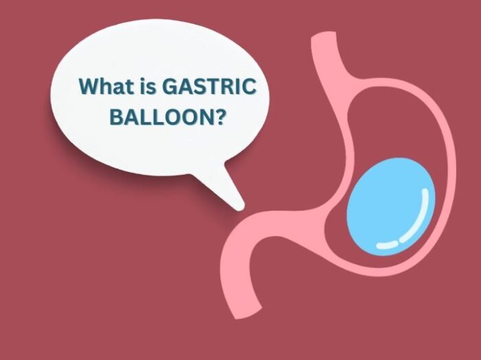 Gastric Balloon Cost 