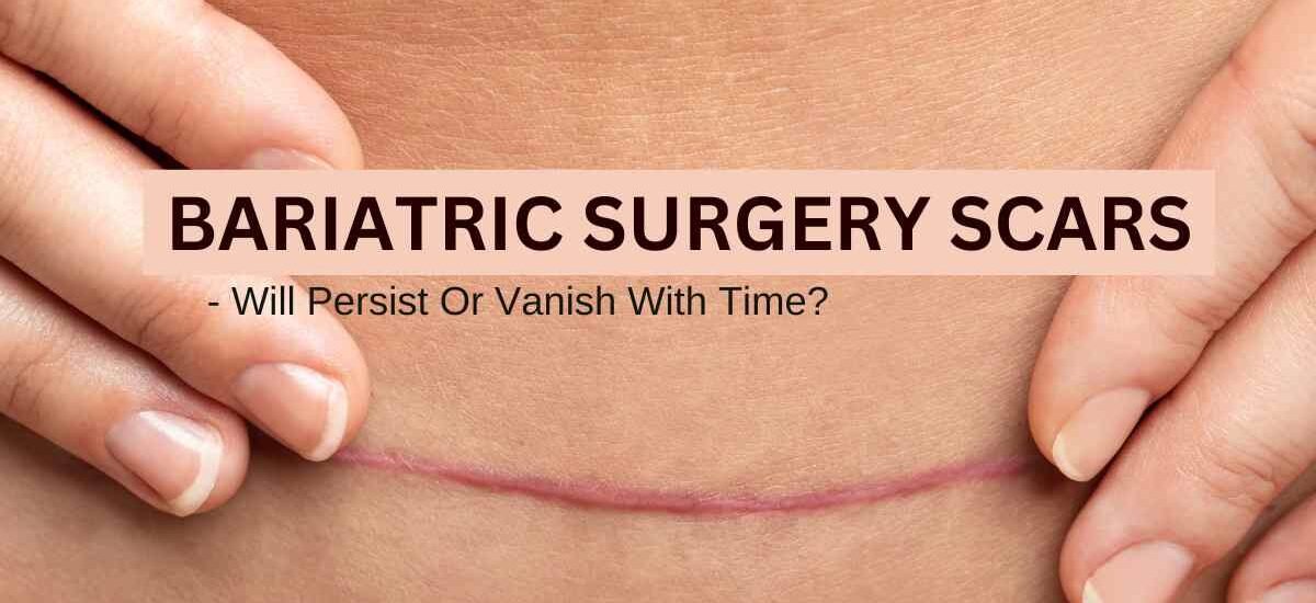 Bariatric Surgery Scars