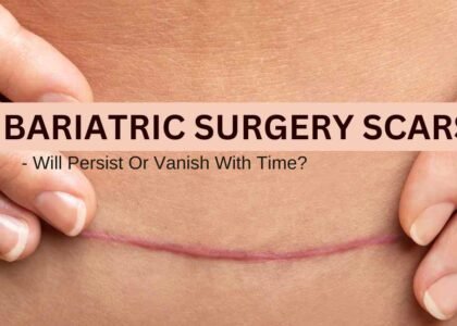 Bariatric Surgery Scars